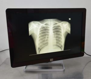 Barco Coronis Fusion (MDCC-6130) 6MP 30" Diagnostic Radiology Display