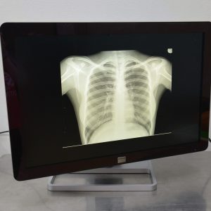 Barco Coronis Fusion (MDCC-6130) 6MP 30" Diagnostic Radiology Display